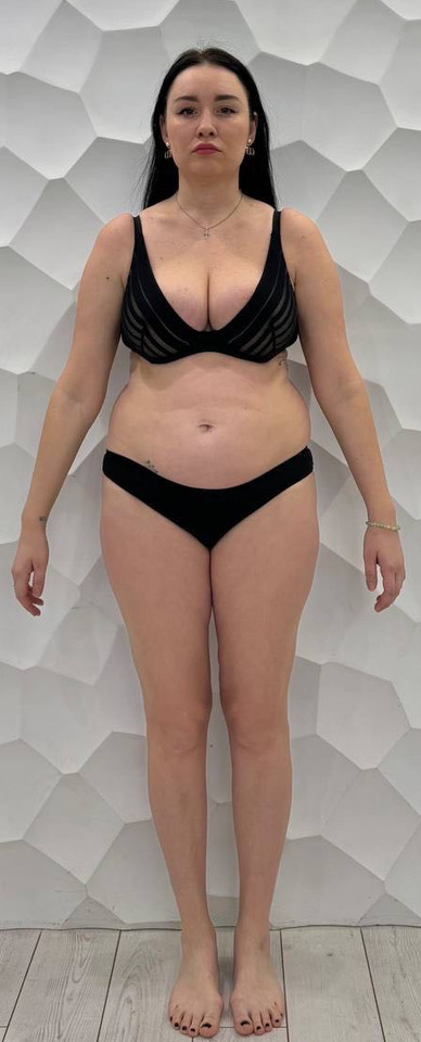 Female transformation before