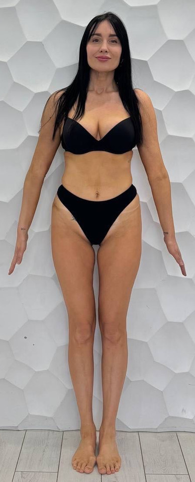 Female transformation after