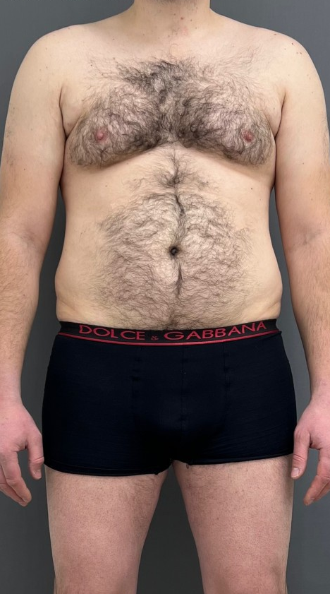 Male transformation before